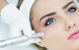 Le Microneedling Evreux Dr Faissinet